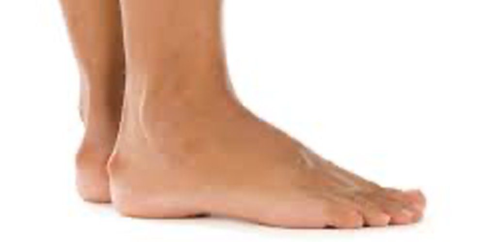 haglunds deformity symptoms causes treatment and diagnosis
