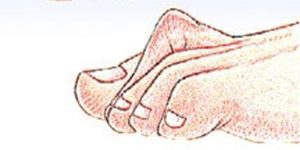 hammertoe and mallet toe what's the difference symptoms and treatment