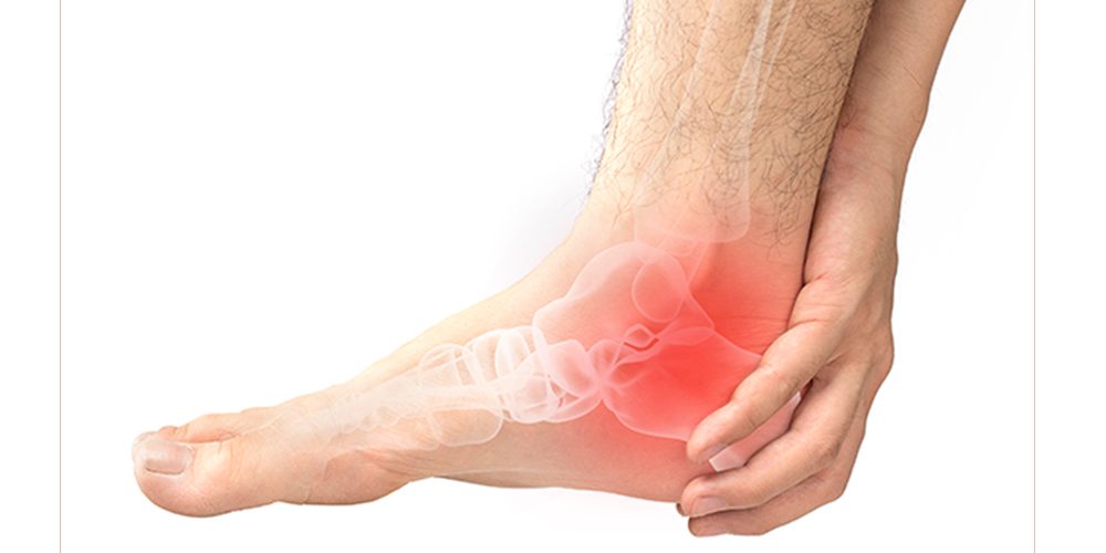 osteoarthritis in foot feet and ankles symptoms diagnosis treatment home remedies and lifestyle changes