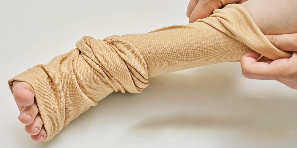 compressions socks tips and tricks a comprehensive guide