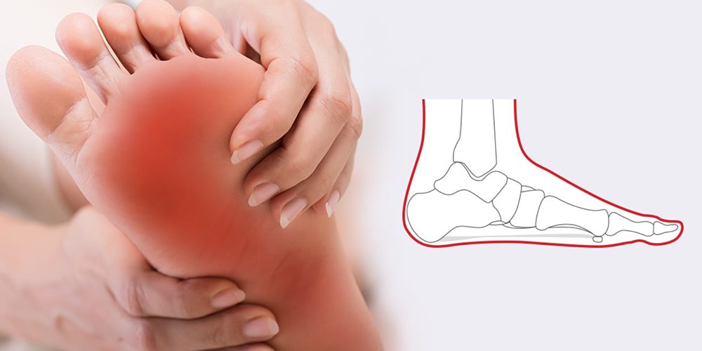 how supportive insoles can fix flat feet