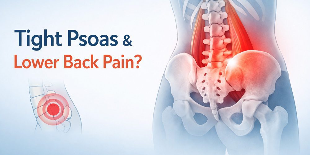 how a tight psoas can cause lower back pain