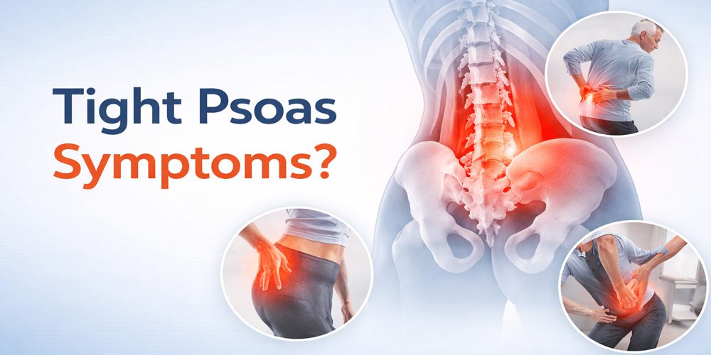 symptoms of a tight psoas